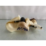 Reservatório De Partida Gm Astra